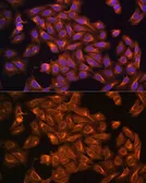 Anti-Merlin antibody used in Immunocytochemistry/ Immunofluorescence (ICC/IF). GTX35202