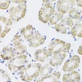 Anti-PP1C gamma antibody used in IHC (Paraffin sections) (IHC-P). GTX35235