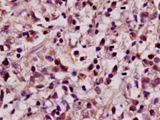 Anti-REST antibody used in IHC (Paraffin sections) (IHC-P). GTX37363
