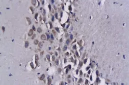 Anti-MCP3 antibody used in IHC (Paraffin sections) (IHC-P). GTX37377