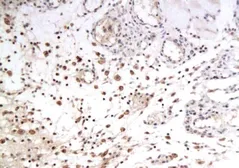 Anti-GLUT12 antibody used in IHC (Paraffin sections) (IHC-P). GTX37419