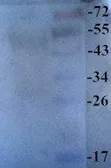 Anti-Surfactant Protein D antibody used in Western Blot (WB). GTX37537