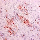 Anti-Rhizopus arrhizus antibody [WSSA-RA-1] used in IHC (Paraffin sections) (IHC-P). GTX39191