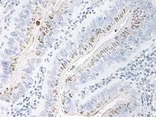 Anti-CXCL2 / GRO beta antibody used in IHC (Paraffin sections) (IHC-P). GTX40895
