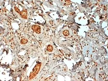 Anti-Estrogen Receptor beta 2 antibody [57/3] used in IHC (Paraffin sections) (IHC-P). GTX41213