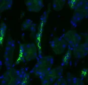 Anti-NCC antibody used in Immunocytochemistry/ Immunofluorescence (ICC/IF). GTX41969