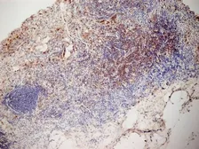 Anti-CD3 antibody [KT3] used in IHC (Frozen sections) (IHC-Fr). GTX42104