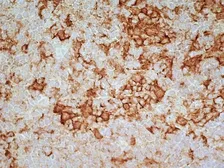 Anti-CD169 antibody [ED3] used in IHC (Frozen sections) (IHC-Fr). GTX42356