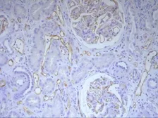 Anti-C4d antibody [10-11] used in IHC (Paraffin sections) (IHC-P). GTX42598
