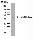 Anti-AMPK alpha 1 + AMPK alpha 2 antibody [84.1] used in Western Blot (WB). GTX42788