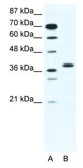 Anti-BHLHB5 antibody, N-term used in Western Blot (WB). GTX44609