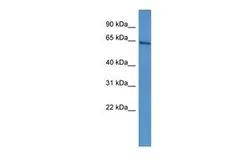 Anti-ARNTL2 antibody, C-term used in Western Blot (WB). GTX44613
