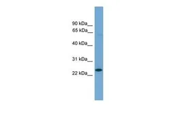 Anti-ASCL3 antibody, Internal used in Western Blot (WB). GTX44656