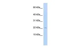 Anti-FKBP2 antibody, N-term used in Western Blot (WB). GTX44851