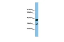 Anti-RTP4 antibody, Internal used in Western Blot (WB). GTX44887
