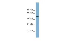 Anti-ACTR3B antibody, N-term used in Western Blot (WB). GTX44914