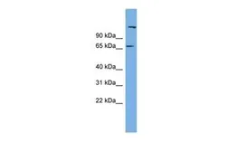 Anti-C12ORF4 antibody, N-term used in Western Blot (WB). GTX44919