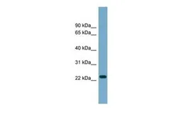 Anti-ARL8B antibody, Internal used in Western Blot (WB). GTX44967