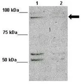 Anti-MAP7D1 antibody, N-term used in Western Blot (WB). GTX44977