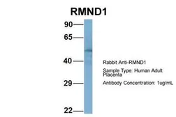 Anti-RMND1 antibody, Internal used in Western Blot (WB). GTX44985