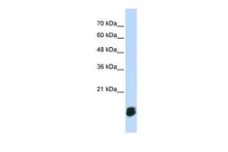 Anti-GLRX5 antibody, Internal used in Western Blot (WB). GTX45005