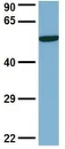 Anti-DCTN4 antibody, N-term used in Western Blot (WB). GTX45016