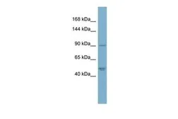Anti-PKP2 antibody, N-term used in Western Blot (WB). GTX45051