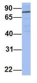 Anti-PNN antibody, N-term used in Western Blot (WB). GTX45056