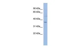 Anti-HMGCLL1 antibody, N-term used in Western Blot (WB). GTX45075