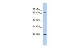 Anti-RPS7 antibody, N-term used in Western Blot (WB). GTX45105