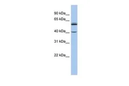 Anti-CYP4V2 antibody, Internal used in Western Blot (WB). GTX45139