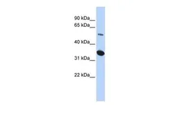 Anti-FAM175B antibody, Internal used in Western Blot (WB). GTX45285