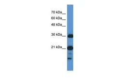 Anti-C1orf144 antibody, N-term used in Western Blot (WB). GTX45302