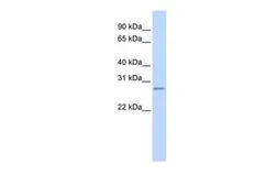 Anti-VASH1 antibody, N-term used in Western Blot (WB). GTX45336