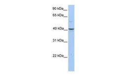 Anti-PELI3 antibody, N-term used in Western Blot (WB). GTX45397