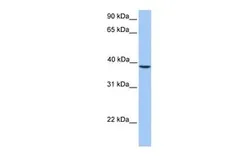 Anti-SUNC1 antibody, C-term used in Western Blot (WB). GTX45411