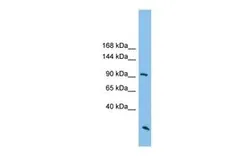Anti-ARHGAP30 antibody, N-term used in Western Blot (WB). GTX45415