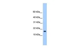 Anti-C6ORF173 antibody, N-term used in Western Blot (WB). GTX45426