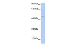 Anti-PAOX antibody, Internal used in Western Blot (WB). GTX45444