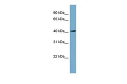 Anti-TSSK2 antibody, Internal used in Western Blot (WB). GTX45453