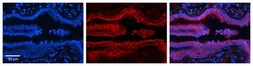 Anti-PDXK antibody, N-term used in IHC (Paraffin sections) (IHC-P). GTX45487