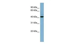 Anti-OSCP1 antibody, N-term used in Western Blot (WB). GTX45509