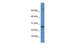 Anti-FAM36A antibody, C-term used in Western Blot (WB). GTX45525