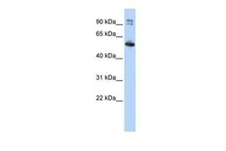 Anti-LRRC50 antibody, N-term used in Western Blot (WB). GTX45546