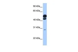 Anti-KLC3 antibody, Internal used in Western Blot (WB). GTX45553