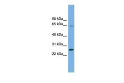 Anti-DHFRL1 antibody, Internal used in Western Blot (WB). GTX45554