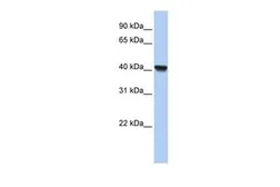 Anti-RLBP1L1 antibody, N-term used in Western Blot (WB). GTX45573