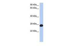 Anti-RAB39B antibody, N-term used in Western Blot (WB). GTX45591