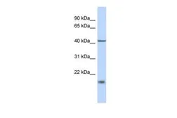 Anti-TBC1D21 antibody, N-term used in Western Blot (WB). GTX45603