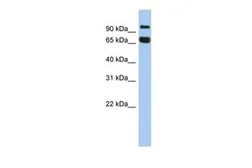 Anti-GGN antibody, N-term used in Western Blot (WB). GTX45630